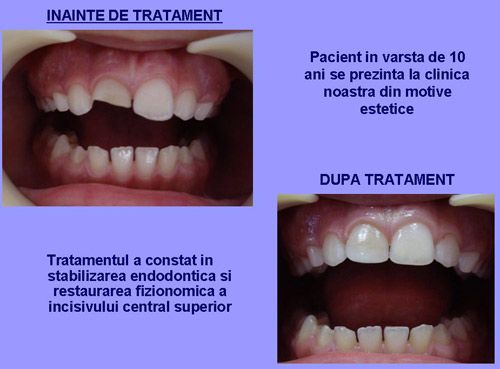 Clinica dentara Dr.Mikaela Oprisan poza 6