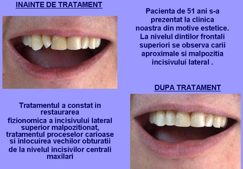 Clinica dentara Dr.Mikaela Oprisan poza 7