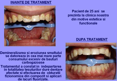 Clinica dentara Dr.Mikaela Oprisan poza 8