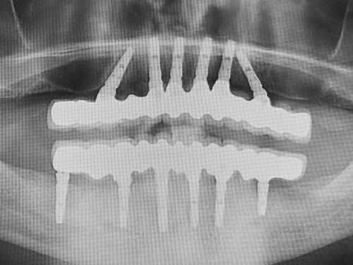 Clinica dentara dr. Dumitrescu Dan Mugur poza 6