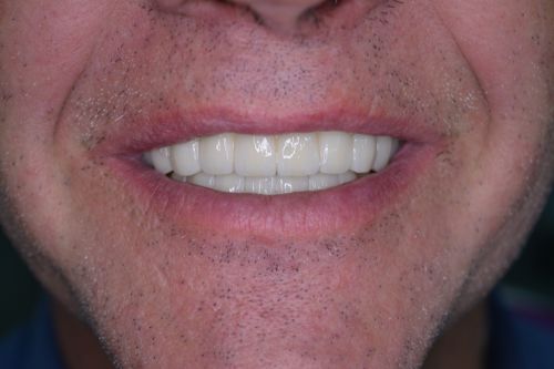 Clinica dentara dr. Dumitrescu Dan Mugur poza 5