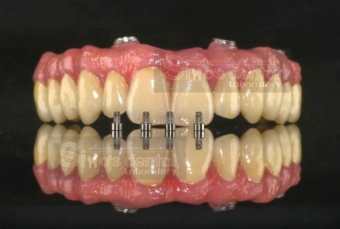 Imagine Invitație la colaborare! Simo's Dental Laboratory