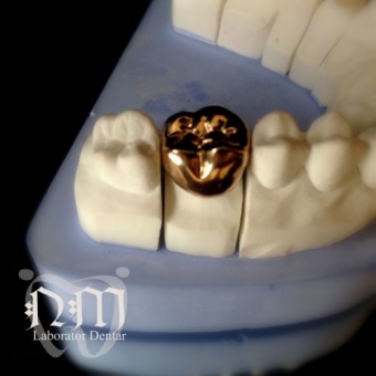 Imagine Laborator dentar invita cabinete si clinici stomatologice spre o colaborare fructuoasa