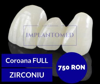 Imagine Coroana zirconiu - 750 ron