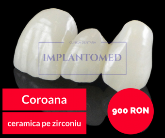 Imagine Reducere coroana ceramica pe suport zirconiu