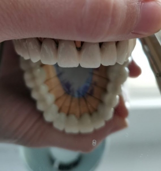 Imagine Laborator dentar caut colaborare cu medic stomatolog