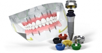 Imagine  Implanturi Dentare Straumann Cluj-Napoca – AnaDent