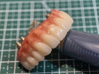 Imagine Tehnician dentar cu experienta, Comuna Berceni Jutet Ilfov