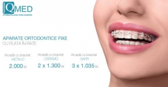 Imagine Aparate dentare cu plata in rate