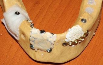 Imagine Angajare medic stomatolog 