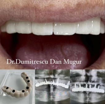 Imagine Chirurgie dentara Ploiesti - Dr. Dumitrescu Dan Mugur