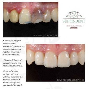 Imagine Fatete dentare Constanta Super Dent 92