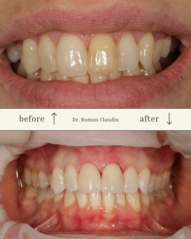 Imagine Fatete dentare Sector 4 - Dental Zen Estetic