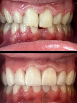 Imagine Fatete dentare Timisoara - DentalTours
