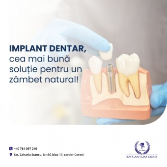 Imagine Implant dentar Brasov - Implantum Dent