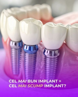 Imagine Implant dentar și sinus lift, Sector 1 - Clinica stomatologică Dr. Serban