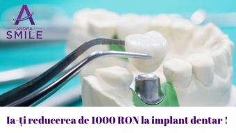 Imagine Implant dentar (1 dinte) 3130 lei in loc de 4130 lei