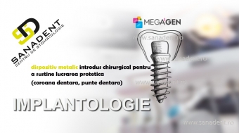 Imagine 10% Reducere la Implanul dentar MegaGen 