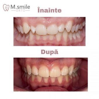 Imagine Control si igienizare profesionala, MSmile Orto