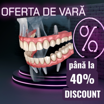 Imagine Oferta reabilitare orala Cluj, implant dentar ImplantFix