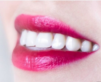 Imagine Sedinta completa de igienizare dentara: periaj profesional si detartraj, airflow