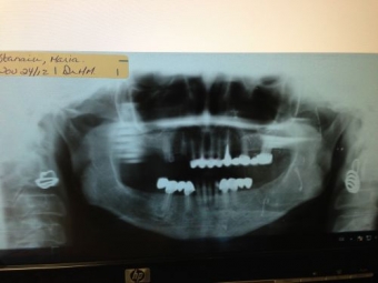 Imagine Colaborare medic ortodont