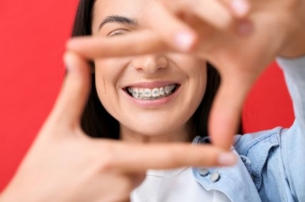 Imagine Obțineți Zâmbetul Perfect cu Aparatul Dentar în Rate!