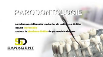 Imagine Tratament parodontoza