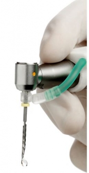 Inovatie in Tratamentul Canalelor radiculare SAF - Self Adjusting File