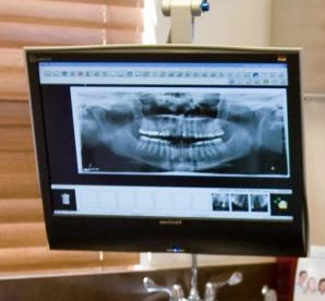 Radiografii dentare digitale: senzori CCD si PSI