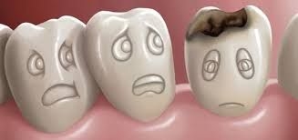 Caria dentara - tratament profilactic