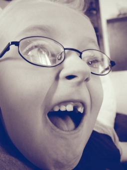 Pierderea primilor dinti: a trage sau a nu trage 