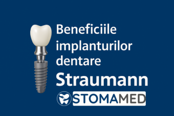 Implant Straumann