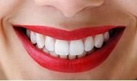 avantaje si dezavantaje implant dentar