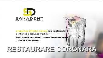restaurare coroana dentara