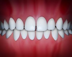 Ortodontia si aparatele dentare, intrabari si raspunsuri!