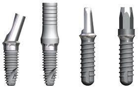 despre tipuri de implant dentar