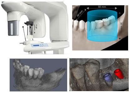 Imagine Cursul Tomografia Computerizata in Stomatologie (CBCT \ DVT \ 3D)