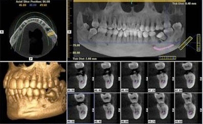 Imagine CBCT - Aplicatii in stomatologie