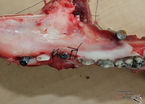 Imagine Intretinerea protezarilor pe implanturi si conduita in complicatiile periimplantare( MEDICI)