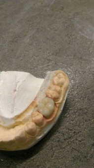 Imagine Laborator de Tehnica dentara din Moldova ofera calitate la preturi accesibile