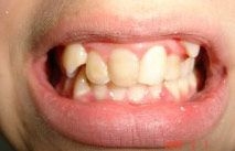 Ortodontia pentru parinti si copii