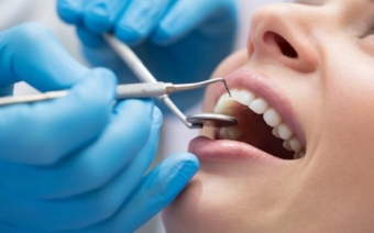 Profilaxia dentara pentru pastrarea dintilor sanatatosi