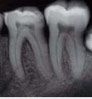 Radiologia dentara- o alegere fara riscuri